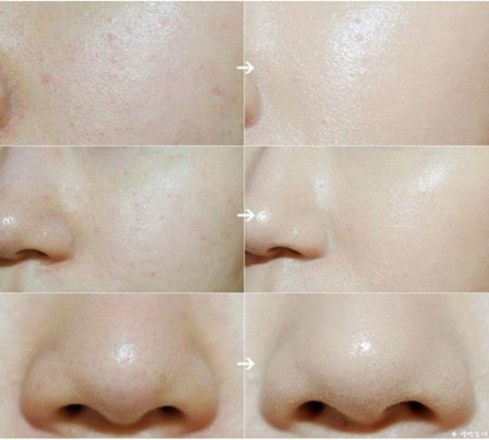 BÍ QUYẾT HOÀN HẢO CHO LỚP NỀN MỊN MÀNG