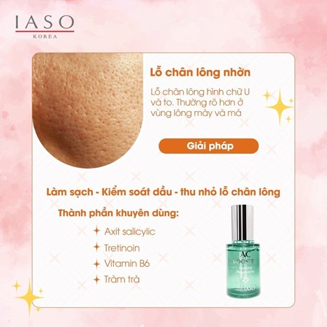 MỤN BIỂU TÌNH Ồ ẠT KIẾP NẠN NÀY GIẢI SAO