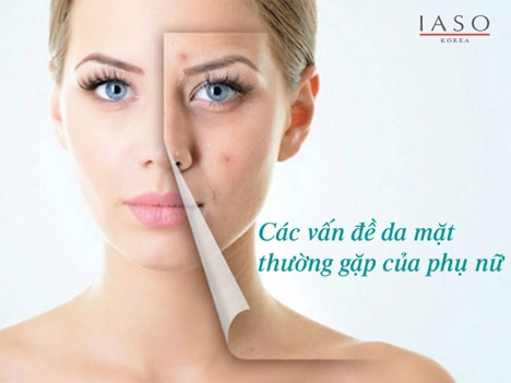 CÁC VẤN ĐỀ DA MẶT THƯỜNG GẶP CỦA PHỤ NỮ