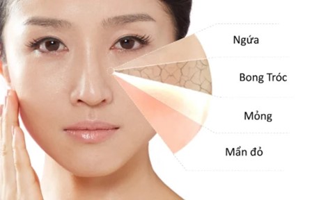 DA NHẠY CẢM NÊN DÙNG MỸ PHẨM NÀO