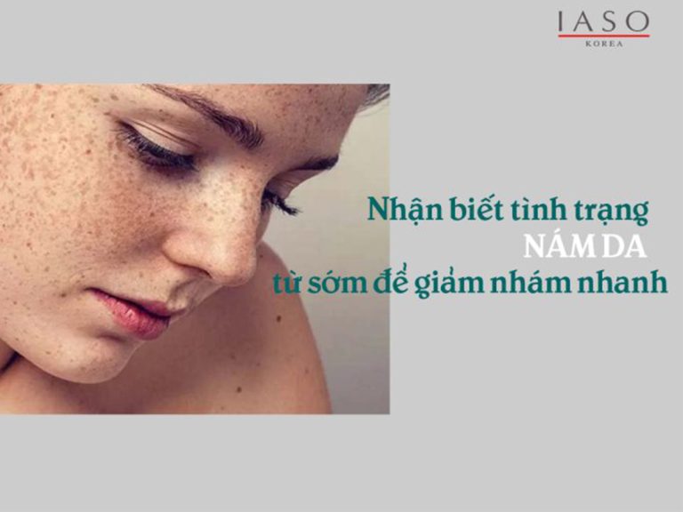 Nhận Biết Tình Trạng Nám Da Từ Sớm Để Giảm Nám Nhanh